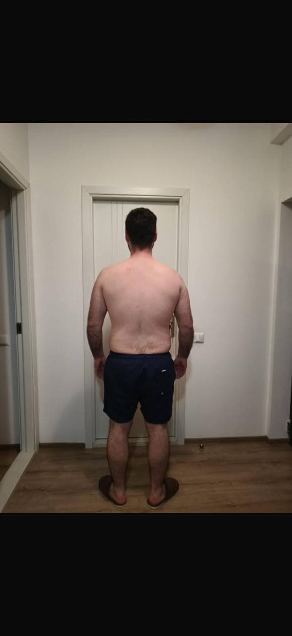 Transformare 1 inainte